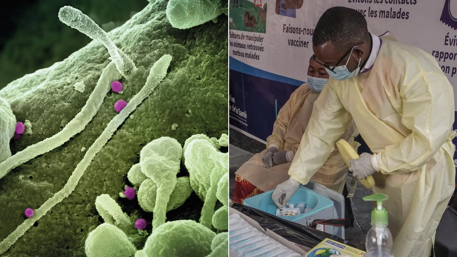 Allerta in Italia: il misterioso virus dal Congo minaccia la salute pubblica!